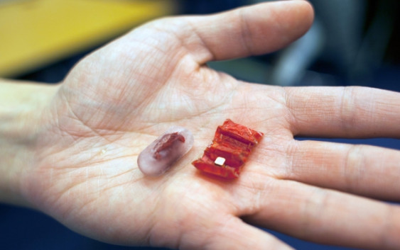 This origami robot can retrieve the batteries you swallow